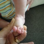 Pieb Calcaneus